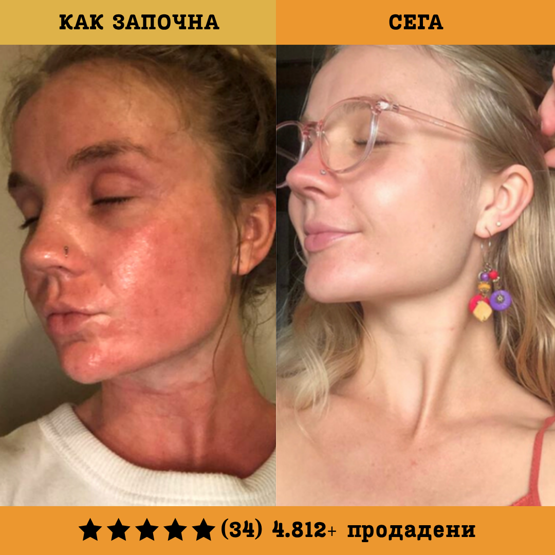 Nevenka - Традиционен мехлем за кожни раздразнения