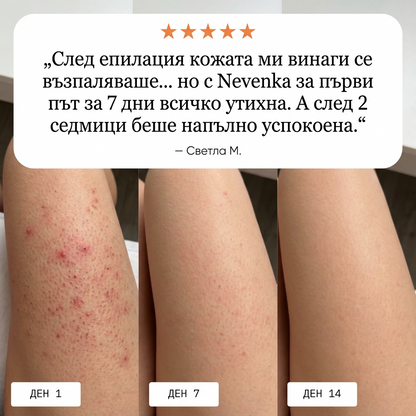 Nevenka - Традиционен мехлем за кожни раздразнения