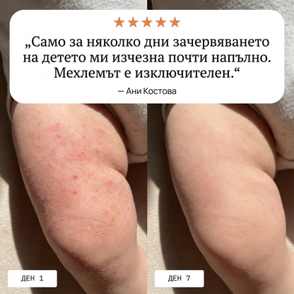 Nevenka - Традиционен мехлем за кожни раздразнения