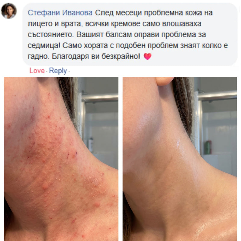 СЛЕД